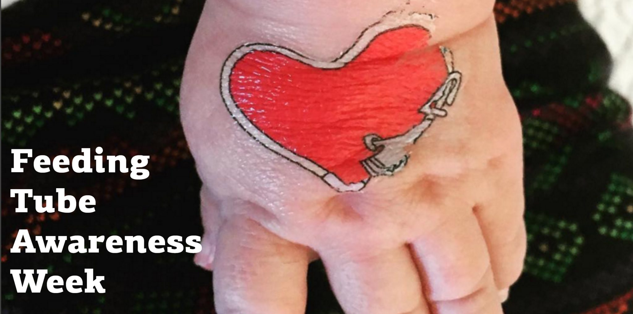 Celebrating Feeding Tube Awareness Pediatric Home Service