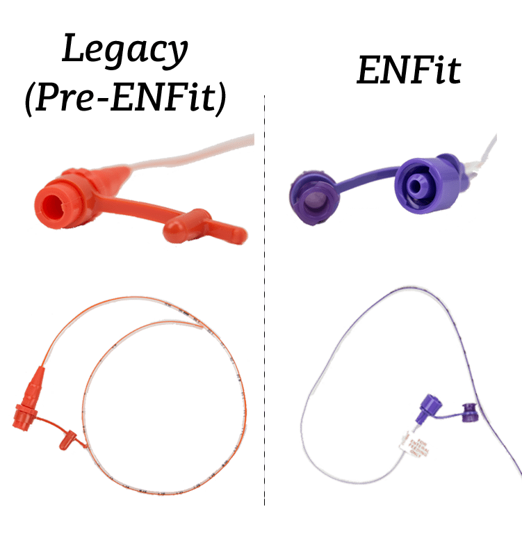 nasal feeding tube legacy and enfit