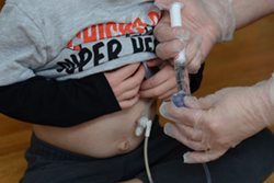 seizure medications may be able to be administered through a child's g-tube