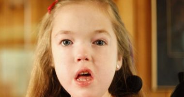 PHS patient Mary Kate has spinal muscular atrophy