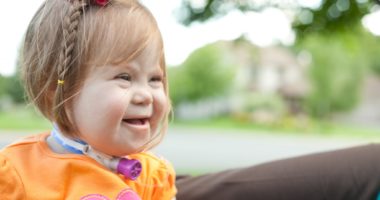 PHS patient Ireland has Down syndrome, a chromosomal abnormality